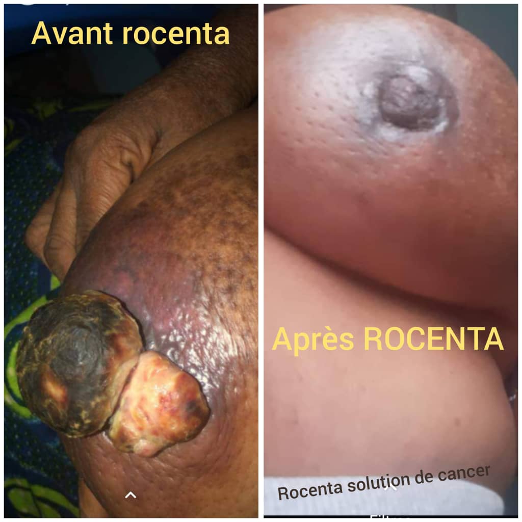 CELLULES SOUCHES DYNACE ROCENTA